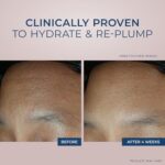 wrinkle and anti aging cream